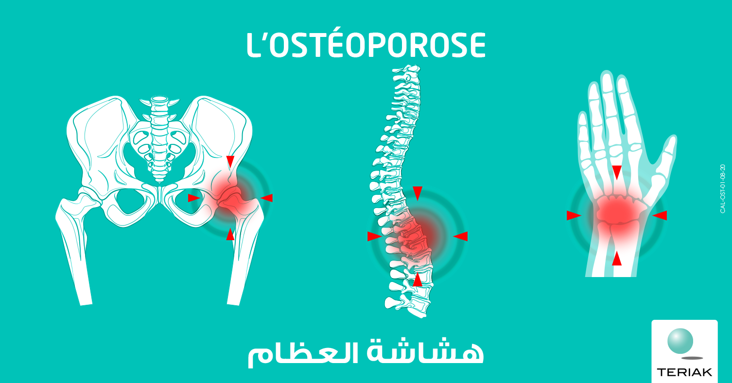 Journée mondiale de l'ostéoporose